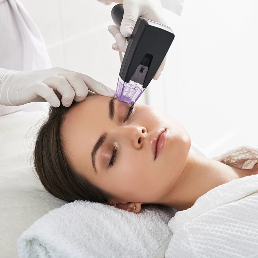 Morpheus8 RF microneedling procedure at Aries Clinic