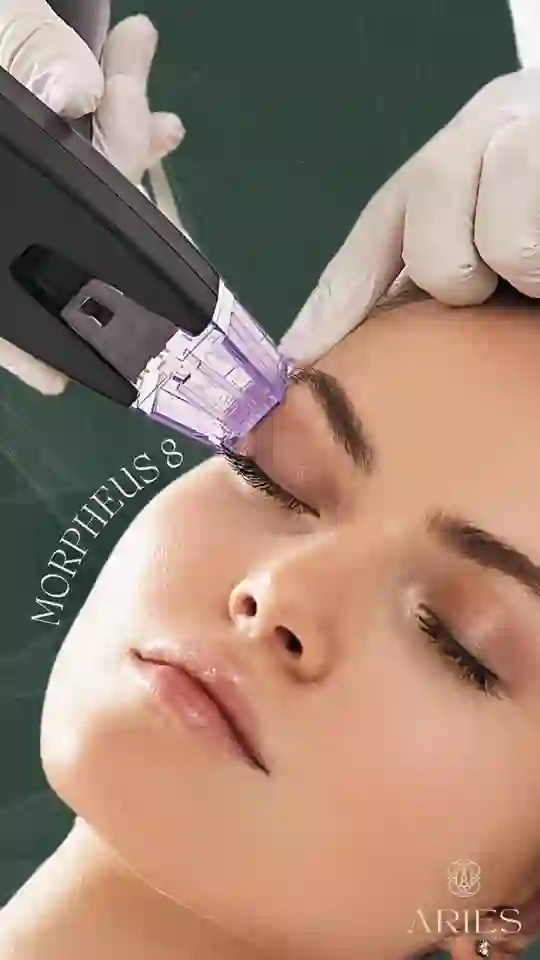 Turn back the clock and glow like never before with Morpheus8 video thumbnail